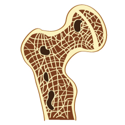 Damages Caused by Cortisone